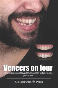 Veneers on four