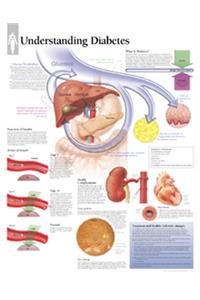 Understanding Diabetes Paper Poster
