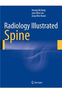 Radiology Illustrated: Spine