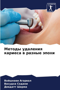 Методы удаления кариеса в разные эпохи