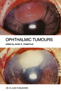 Ophthalmic Tumours