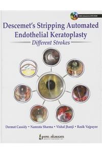 Descemet's Stripping Automated Endothelial Keratoplasty: Different Strokes