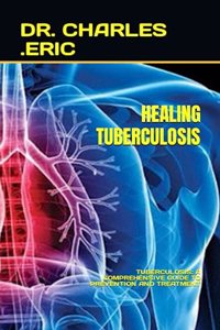 Healing Tuberculosis