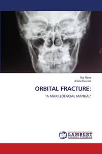 Orbital Fracture