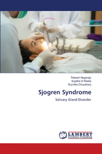 Sjogren Syndrome