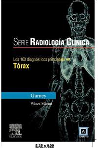 Src: 100 Diagnosticos Principales En Torax