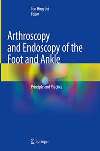 Arthroscopy and Endoscopy of the Foot and Ankle