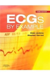 Ecgs by Example