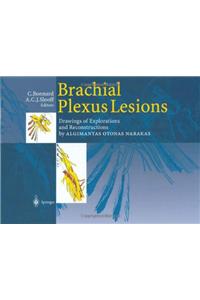 Brachial Plexus Lesions