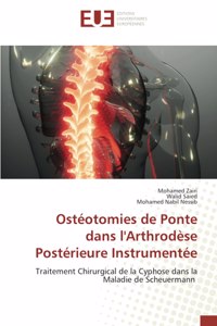 Ostéotomies de Ponte dans l'Arthrodèse Postérieure Instrumentée