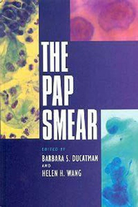 Pap Smear