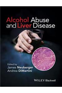 Alcohol Abuse and Liver Disease