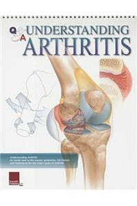 Understanding Arthritis Flip Chart