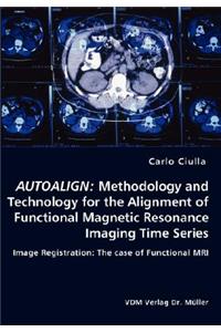 Autoalign