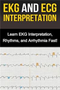 EKG and ECG Interpretation