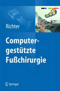 Computergestützte Fußchirurgie