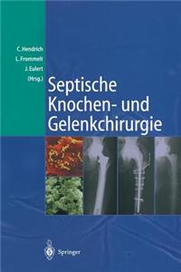 Septische Knochen-und Gelenkchirurgie