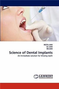 Science of Dental Implants