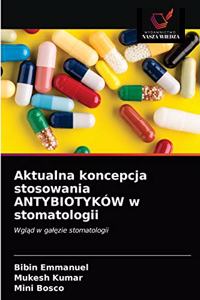 Aktualna koncepcja stosowania ANTYBIOTYKÓW w stomatologii