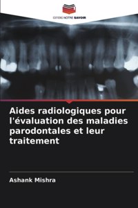 Aides radiologiques pour l'évaluation des maladies parodontales et leur traitement