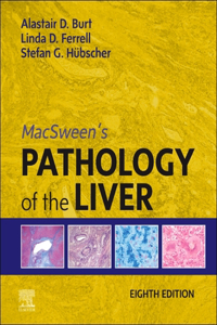 Macsween's Pathology of the Liver, E-Book