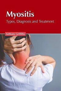 Myositis: Types, Diagnosis and Treatment
