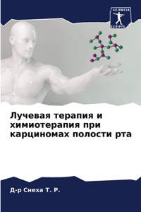 Лучевая терапия и химиотерапия при карцин