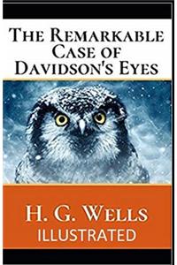 The Remarkable Case of Davidson's Eyes Illustrated