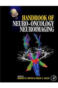 Handbook of Neuro-Oncology Neuroimaging