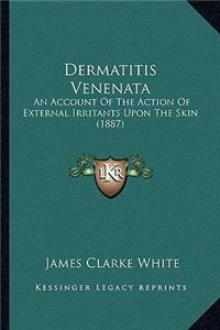 Dermatitis Venenata