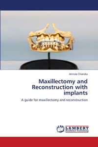 Maxillectomy and Reconstruction with implants