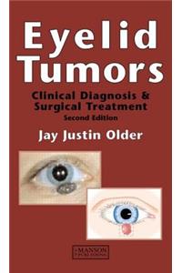 Eyelid Tumors