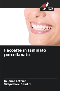 Faccette in laminato porcellanato