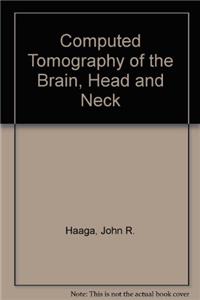 Computed Tomography of the Brain, Head and Neck