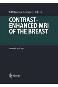 Contrast-Enhanced MRI of the Breast