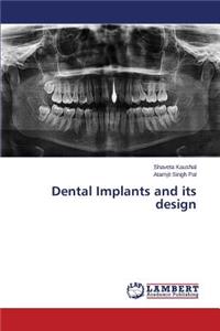 Dental Implants and Its Design