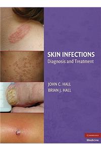 Skin Infections