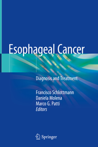 Esophageal Cancer