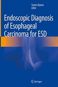 Endoscopic Diagnosis of Esophageal Carcinoma for Esd