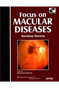 Focus on Macular Diseases