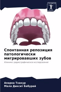 Спонтанная репозиция патологически мигр&