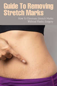 Guide To Removing Stretch Marks