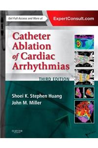 Catheter Ablation of Cardiac Arrhythmias