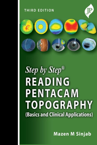 Step by Step: Reading Pentacam Topography: Basics and Clinical Applications