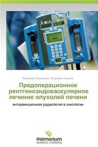 Predoperatsionnoe Rentgenoendovaskulyarnoe Lechenie Opukholey Pecheni