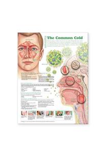 Understanding the Common Cold Anatomical Chart