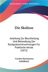 Skoliose