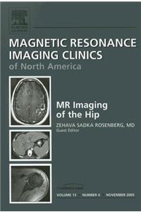 The Hip, An Issue of Magnetic Resonance Imaging Clinics (The Clinics: Radiology)