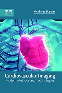 Cardiovascular Imaging: Modern Methods and Technologies