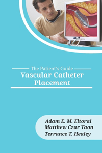Vascular Catheter Placement